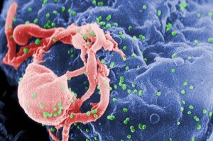 Virusul_HIV_SIDA