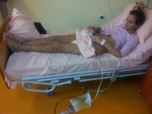 2 accident