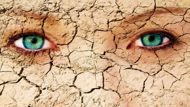 32710133 - cracked skin